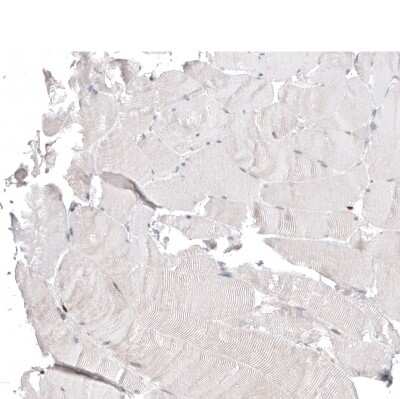 Immunohistochemistry-Paraffin: ACOT4 Antibody [NBP1-83539]