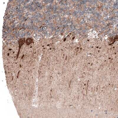 Immunohistochemistry-Paraffin: ACOT4 Antibody [NBP1-83539]