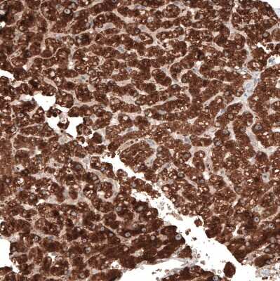 Immunohistochemistry-Paraffin: ACOT4 Antibody [NBP1-83539]