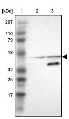 Western Blot: ACOT4 Antibody [NBP1-83539]