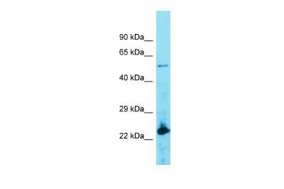 Western Blot: ACOT4 Antibody [NBP2-82575]