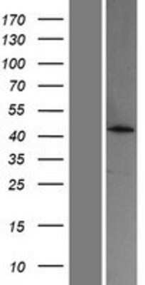 Western Blot: ACOT4 Overexpression Lysate [NBP2-05401]