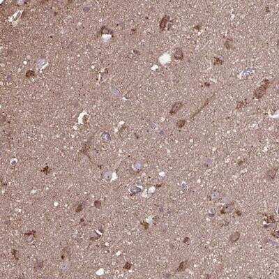 Immunohistochemistry-Paraffin: ACOT6 Antibody [NBP2-31708]