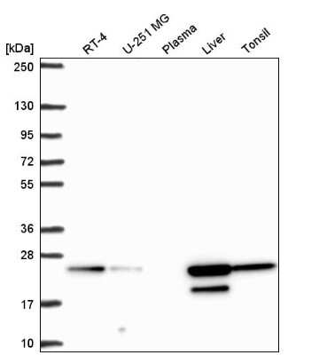 Western Blot: ACOT6 Antibody [NBP2-31708]