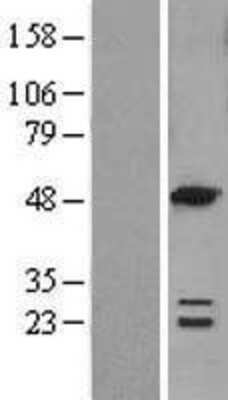 Western Blot: ACOT6 Overexpression Lysate [NBL1-07248]