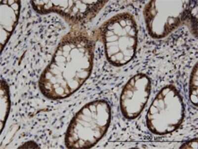 Immunohistochemistry-Paraffin: ACOT7 Antibody (1E7) [H00011332-M02]