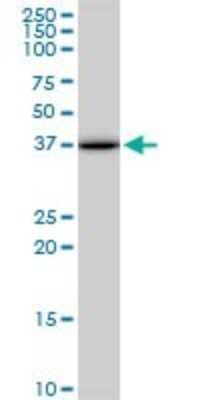 Western Blot: ACOT7 Antibody (1E7) [H00011332-M02]