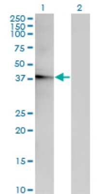 Western Blot: ACOT7 Antibody (1E7) [H00011332-M02]