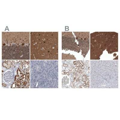 Immunohistochemistry-Paraffin: ACOT7 Antibody [NBP1-89278]