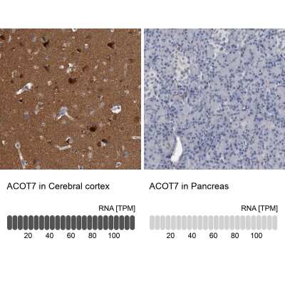 Immunohistochemistry-Paraffin: ACOT7 Antibody [NBP1-89278]