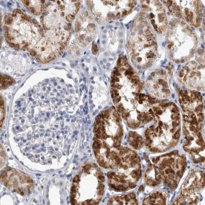 Immunohistochemistry-Paraffin: ACOT7 Antibody [NBP1-89278]