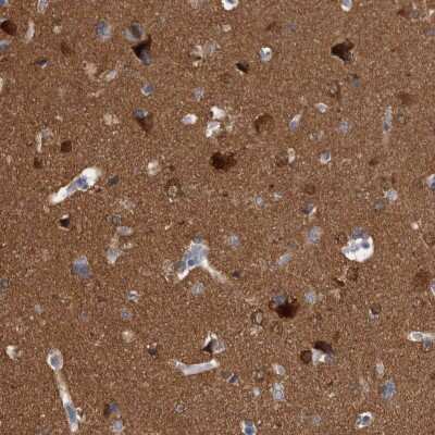 Immunohistochemistry-Paraffin: ACOT7 Antibody [NBP1-89278]