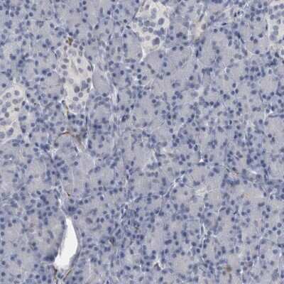 Immunohistochemistry-Paraffin: ACOT7 Antibody [NBP1-89278]