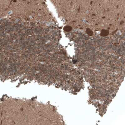 Immunohistochemistry-Paraffin: ACOT7 Antibody [NBP1-89279]