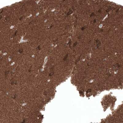 Immunohistochemistry-Paraffin: ACOT7 Antibody [NBP1-89279]