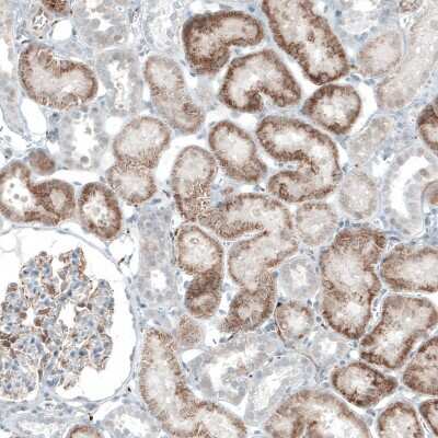 Immunohistochemistry-Paraffin: ACOT7 Antibody [NBP1-89279]