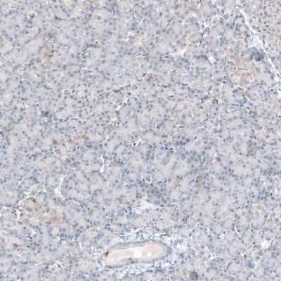 Immunohistochemistry-Paraffin: ACOT7 Antibody [NBP1-89279]