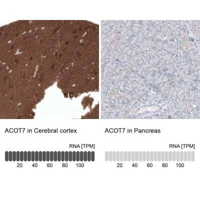 Immunohistochemistry-Paraffin: ACOT7 Antibody [NBP1-89279]