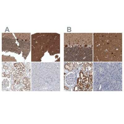 Immunohistochemistry-Paraffin: ACOT7 Antibody [NBP1-89279]