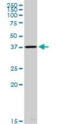 Western Blot: ACOT7 Antibody [H00011332-B01P]