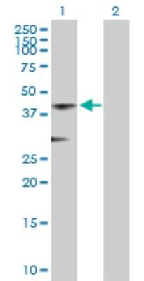 Western Blot: ACOT7 Antibody [H00011332-B01P]