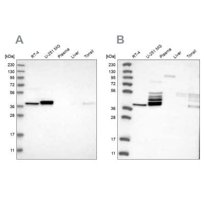 Western Blot: ACOT7 Antibody [NBP1-89278]