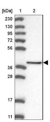 Western Blot: ACOT7 Antibody [NBP1-89279]