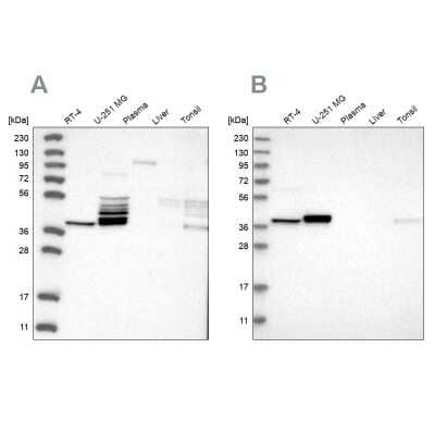 Western Blot: ACOT7 Antibody [NBP1-89279]