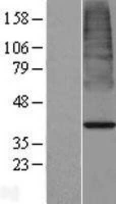 Western Blot: ACOT7 Overexpression Lysate [NBP2-04869]