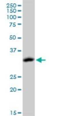 Western Blot: ACOT8 Antibody (3F1) [H00010005-M03]