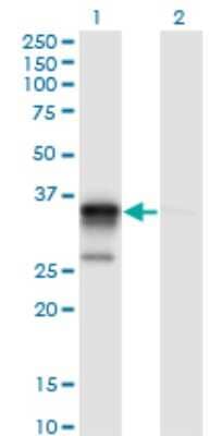 Western Blot: ACOT8 Antibody (3F1) [H00010005-M03]