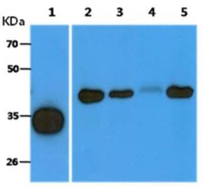 Western Blot: ACOT8 Antibody (4D10)BSA Free [NBP2-59419]