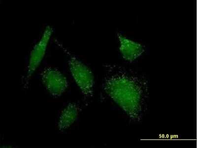 Immunocytochemistry/ Immunofluorescence: ACOT8 Antibody [H00010005-B01P]