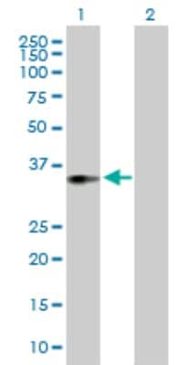 Western Blot: ACOT8 Antibody [H00010005-B01P]