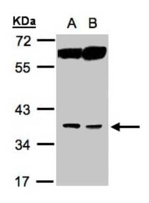 Western Blot: ACOT8 Antibody [NBP1-32452]