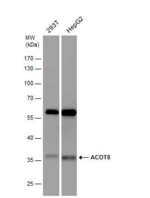 Western Blot: ACOT8 Antibody [NBP1-32452]