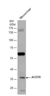 Western Blot: ACOT8 Antibody [NBP1-32452]