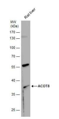 Western Blot: ACOT8 Antibody [NBP1-32452]