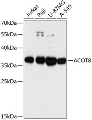 Western Blot: ACOT8 AntibodyAzide and BSA Free [NBP2-92103]