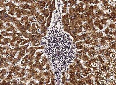 Immunohistochemistry-Paraffin: ACOX1 Antibody (003) [NBP2-89864]