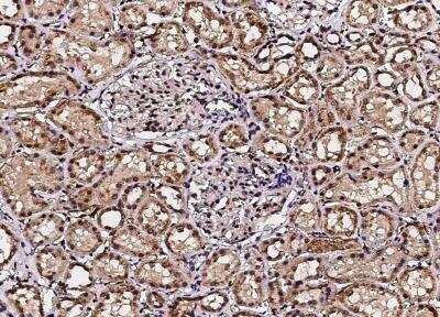 Immunohistochemistry-Paraffin: ACOX1 Antibody (003) [NBP2-89864]