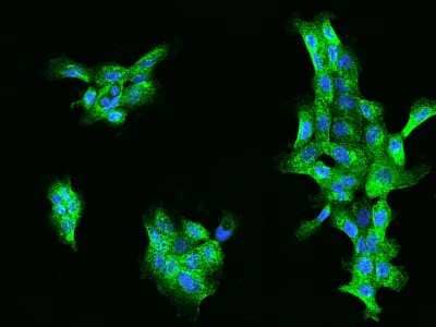 Immunocytochemistry/ Immunofluorescence: ACOX1 Antibody [NBP2-97895]