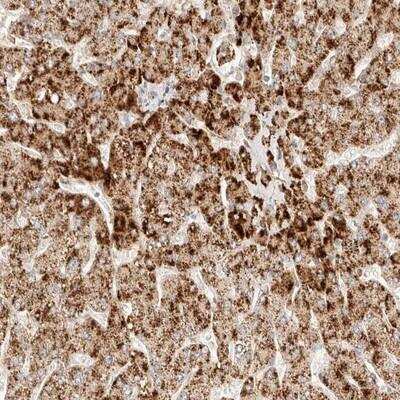 Immunohistochemistry-Paraffin: ACOX1 Antibody [NBP1-80949]