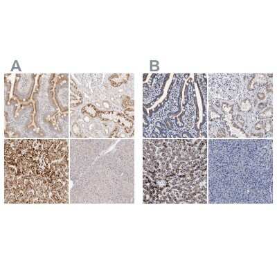 Immunohistochemistry-Paraffin: ACOX1 Antibody [NBP1-80949]