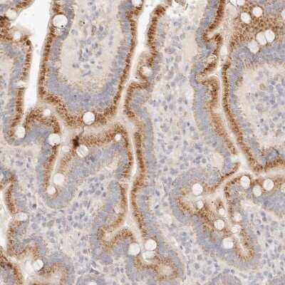 Immunohistochemistry-Paraffin: ACOX1 Antibody [NBP1-80949]