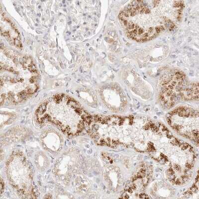 Immunohistochemistry-Paraffin: ACOX1 Antibody [NBP1-80949]