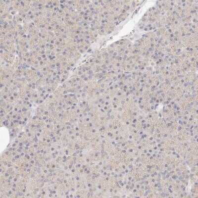 Immunohistochemistry-Paraffin: ACOX1 Antibody [NBP1-80949]