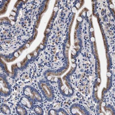 Immunohistochemistry-Paraffin: ACOX1 Antibody [NBP1-80950]