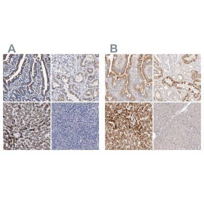 Immunohistochemistry-Paraffin: ACOX1 Antibody [NBP1-80950]