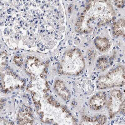 Immunohistochemistry-Paraffin: ACOX1 Antibody [NBP1-80950]